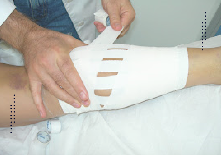 Ligaduras FUncionais Curso-01